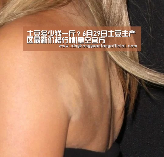 土豆多少钱一斤?6月29日土豆主产区最新价格行情|星空官方(图4) 星空官方